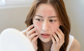 Cách chăm sóc da nhạy cảm vào mùa hè