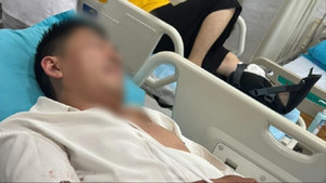 Thẩm phán ở Lâm Đồng bị chém trọng thương