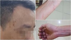 Chủ tịch Hà Nội chỉ đạo xử lý nghiêm vụ 2 phóng viên bị hành hung khi tác nghiệp