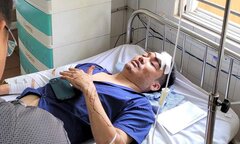 Hành khách trong vụ hai xe khách va chạm ở Gia Lai: Tài xế chạy rất nhanh