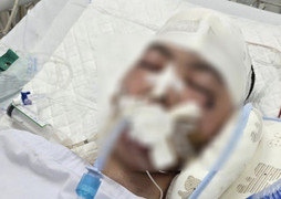 Chuyển nam sinh lớp 8 bị đánh chấn thương sọ não tới Bệnh viện Nhi Trung ương