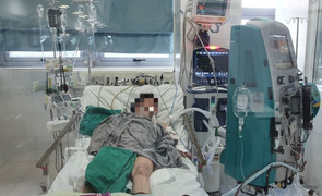 Cập nhật tình hình sức khoẻ 3 bệnh nhân nặng vụ cháy nhà trọ ở Trung Kính