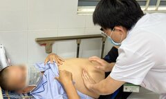 Nghiện ăn rau sống, người đàn ông bị sán lá gan bám chặt