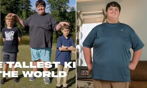 Cậu bé 10 tuổi cao 1,9m và những rắc rối do thân hình khổng lồ
