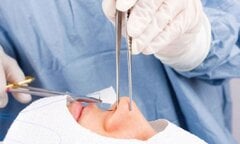 Điều tra vụ người phụ nữ tử vong sau khi sửa mũi tại thẩm mỹ viện ở TP.HCM