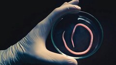 6 loại giun sán ký sinh trong cơ thể người phụ nữ