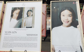 Cuộc sống mới của cô gái mắc bệnh bạch biến từng bị bạn bè xa lánh