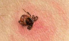 Suy đa tạng do bị mò đốt