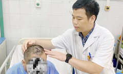 Người đàn ông trầm cảm tự đóng đinh sắt vào đầu