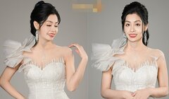 Cuộc sống mới của người phụ nữ từng bị chồng tạt axit để lại vết sẹo hơn 30cm