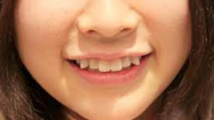 Tại sao rất nhiều người Nhật có hàm răng không đều?