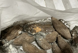 Ăn khoai lang kiểu này, cô gái 26 tuổi bàng hoàng nhận tin mắc ung thư gan