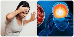 4 dấu hiệu cảnh báo cơn đột quỵ cần xử trí nhanh