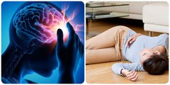 5 triệu chứng sắp bị đột quỵ não