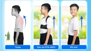 Nhận biết gù lưng ở trẻ và giải pháp từ đai chống gù lưng PITA-SAPO