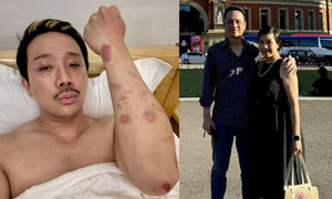 Sao Việt 14/8: Trấn Thành bầm dập khi quay phim Tết, vợ chồng Mỹ Linh tình tứ