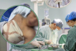 Thẩm mỹ viện lừa chàng trai thiểu năng trí tuệ làm phẫu thuật nâng ngực