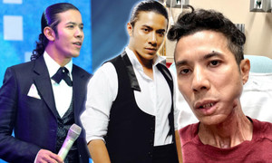 Kasim Hoàng Vũ: 'Nam thần nhạc rock' trở nên tiều tụy vì bạo bệnh