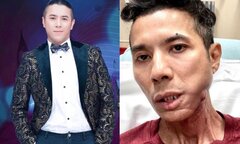 Showbiz 19/8: Ê-kíp Ma Da tung MV do Cẩm Ly hát, Kasim Hoàng Vũ chia sẻ bệnh tật