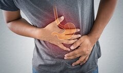 Dấu hiệu cảnh báo bạn có thể bị ung thư dạ dày cần khám sớm