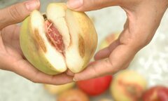 Hai vợ chồng cùng bị ung thư, nguyên nhân từ thói quen ăn uống tiết kiệm