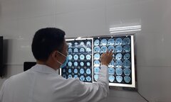 Co giật vì sán làm tổ trong não, 'thủ phạm' là món ăn khoái khẩu của nhiều người