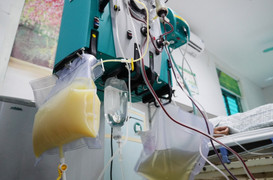 Huyết tương người đàn ông trắng đục như sữa