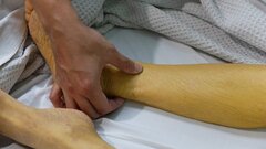 Da vàng như nghệ sau khi uống thuốc mua trên mạng