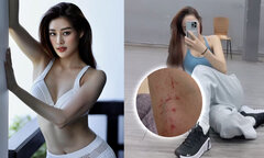 Sao Việt 9/9: Khánh Vân khoe ảnh bạn trai chụp, Minh Hằng bầm dập khi tập nhảy
