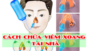 Cách chữa viêm xoang không dùng thuốc hiệu quả