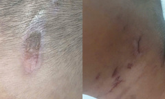 Bé 6 tuổi ở TP.HCM nghi bị bạo hành: Mẹ dằn vặt khi giao con cho 'chồng hờ'