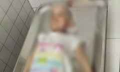 Bé gái 5 tuổi tử vong nghi do bạo hành: Tạm giữ hình sự người mẹ