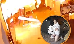 Mẹ bỏng nặng vẫn cố gắng cứu con 2 tuổi thoát khỏi vụ nổ khí gas