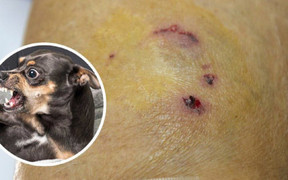 Sau hơn 1 tháng bị chó dại xông vào trường cắn, bé trai 7 tuổi tử vong 