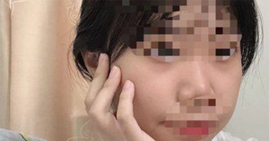 Áp lực học tập khiến nữ sinh cấp 3 Trung Quốc già nua như người 30 tuổi