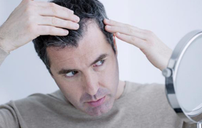 Nguyên nhân rụng tóc ở nam