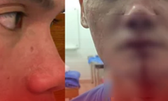 Cầu thủ chặn đường gây sự, bị đối phương đánh chảy máu mũi