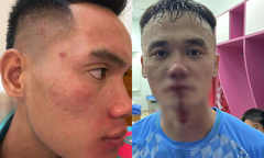 2 cầu thủ Hạng Nhất đánh nhau đối mặt án phạt nặng