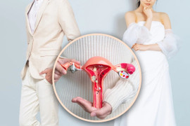 Vợ giấu bệnh tâm thần và cắt bỏ tử cung, tòa án chấp thuận cho chồng hủy hôn