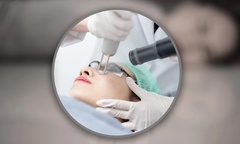 Cô gái chết sau 10 ngày xóa vết bớt bằng laser