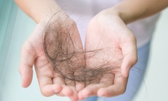Sau hóa trị ung thư, bao lâu thì tóc mọc lại? 