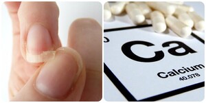 Thiếu canxi gây ra những bệnh gì?