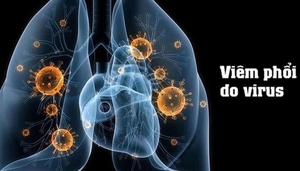 Bộ Y tế cập nhật thông tin về dịch bệnh do virus gây viêm phổi tại Trung Quốc