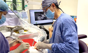 AI trong cấy ghép Implant tại Elite Dental: Tối ưu thời gian, tăng độ chính xác