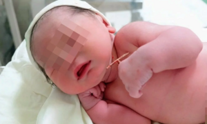 Bé gái chào đời cùng vòng tránh thai của mẹ