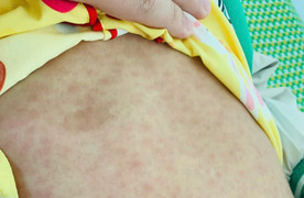 3 trẻ tử vong ở huyện miền núi Nam Trà My: Sở Y tế Quảng Nam thông tin