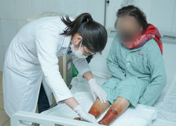 Hoại tử chân do ngâm bột lạ để giữ ấm