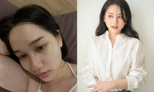 Trúc Anh 'Mắt biếc' suy sụp vì trầm cảm, ngoại hình tàn tạ đến xót xa 