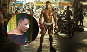 Hành hung nhân viên bảo vệ, cao thủ 2 môn võ bị đánh bầm dập