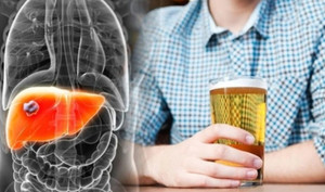5 loại nước tàn phá gan nhanh hơn cả rượu bia